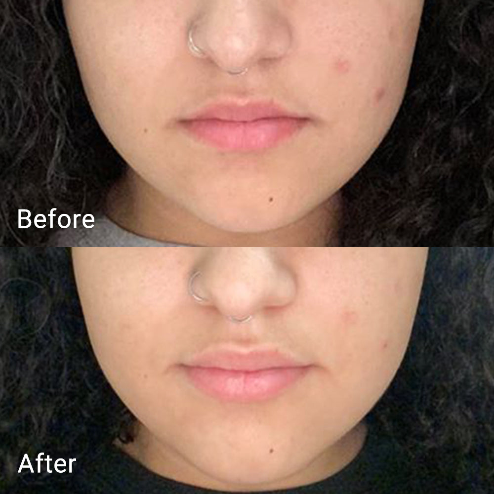 The VIRAL Calendula Peel Off Mask