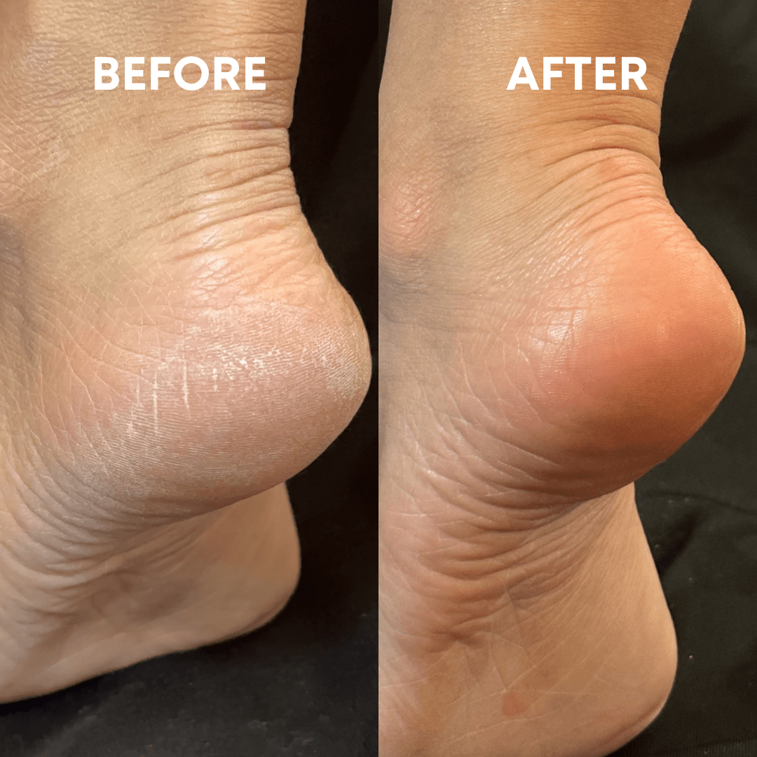 The (VIRAL) Cheeky Foot File