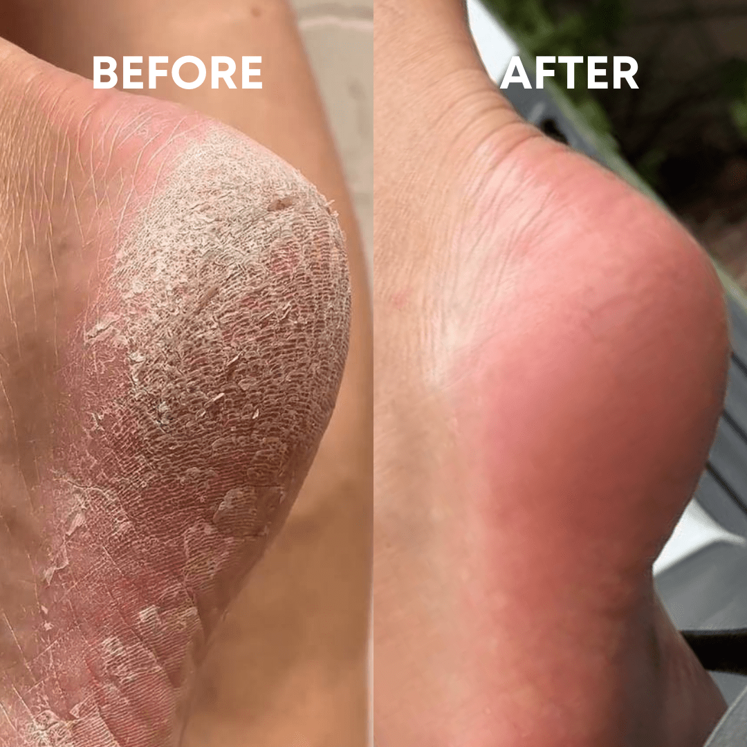 The (VIRAL) Cheeky Foot File