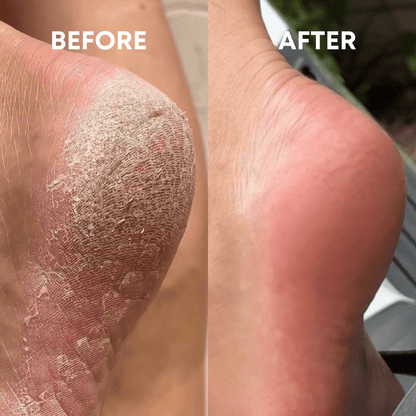 The (VIRAL) Cheeky Foot File